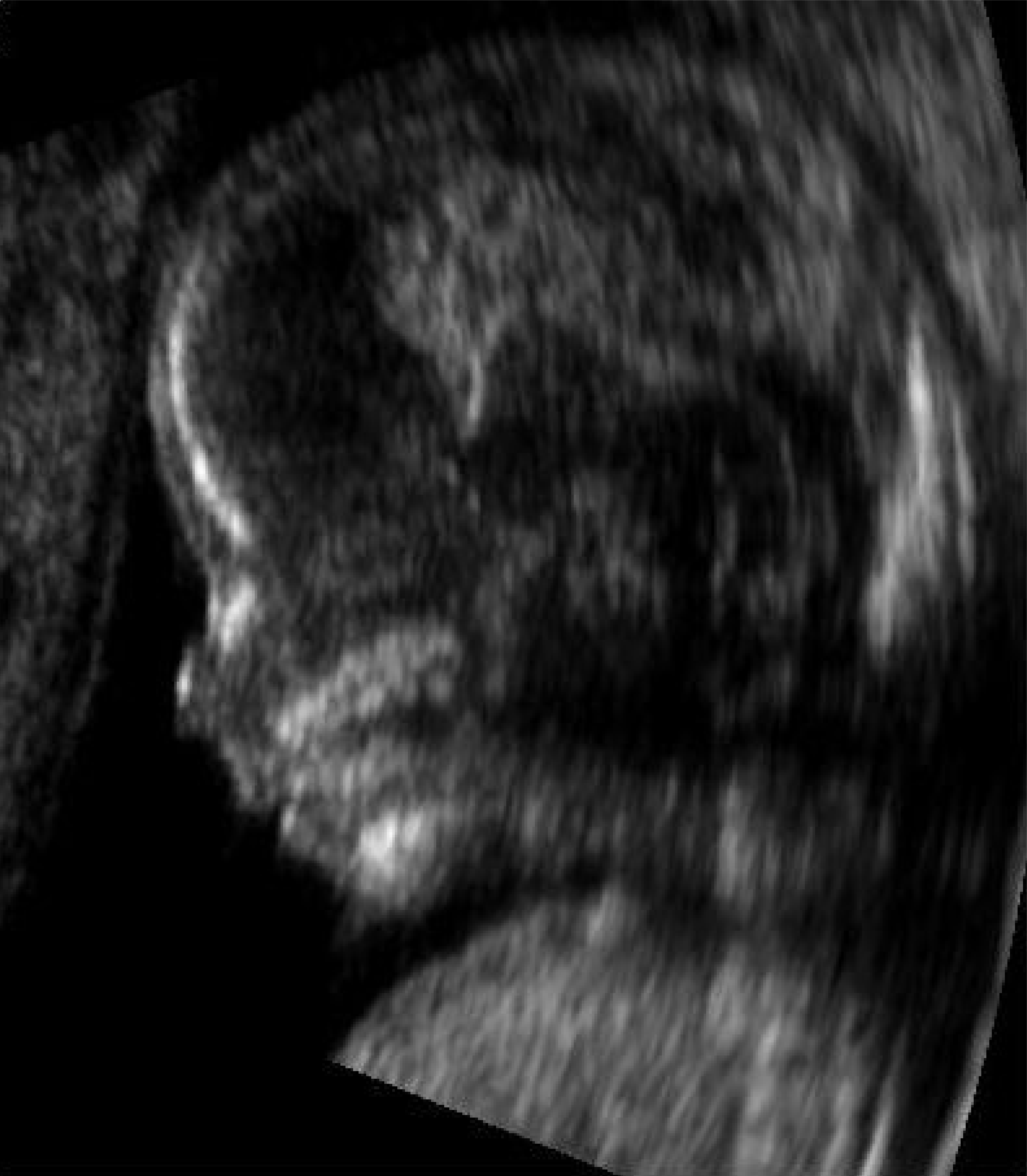 ultrasound scan of an embryo